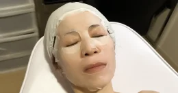 スキンチェック